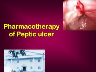 Pharmacotherapy
of Peptic ulcer
 