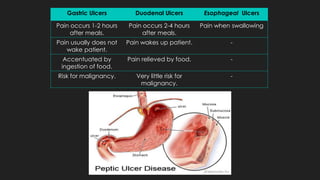 Gastric Ulcers Duodenal Ulcers Esophageal Ulcers
Pain occurs 1-2 hours
after meals.
Pain occurs 2-4 hours
after meals.
Pain when swallowing
Pain usually does not
wake patient.
Pain wakes up patient. -
Accentuated by
ingestion of food.
Pain relieved by food. -
Risk for malignancy. Very little risk for
malignancy.
-
 