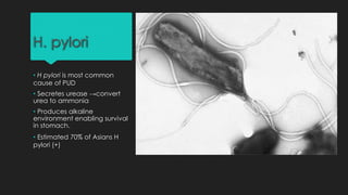 H. pylori
• H pylori is most common
cause of PUD
• Secretes urease →convert
urea to ammonia
• Produces alkaline
environment enabling survival
in stomach.
• Estimated 70% of Asians H
pylori (+)
 