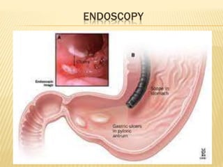 ENDOSCOPY
 