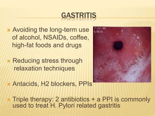 GASTRITIS
 Avoiding the long-term use
of alcohol, NSAIDs, coffee,
high-fat foods and drugs
 Reducing stress through
relaxation techniques
 Antacids, H2 blockers, PPIs
 Triple therapy: 2 antibiotics + a PPI is commonly
used to treat H. Pylori related gastritis
 