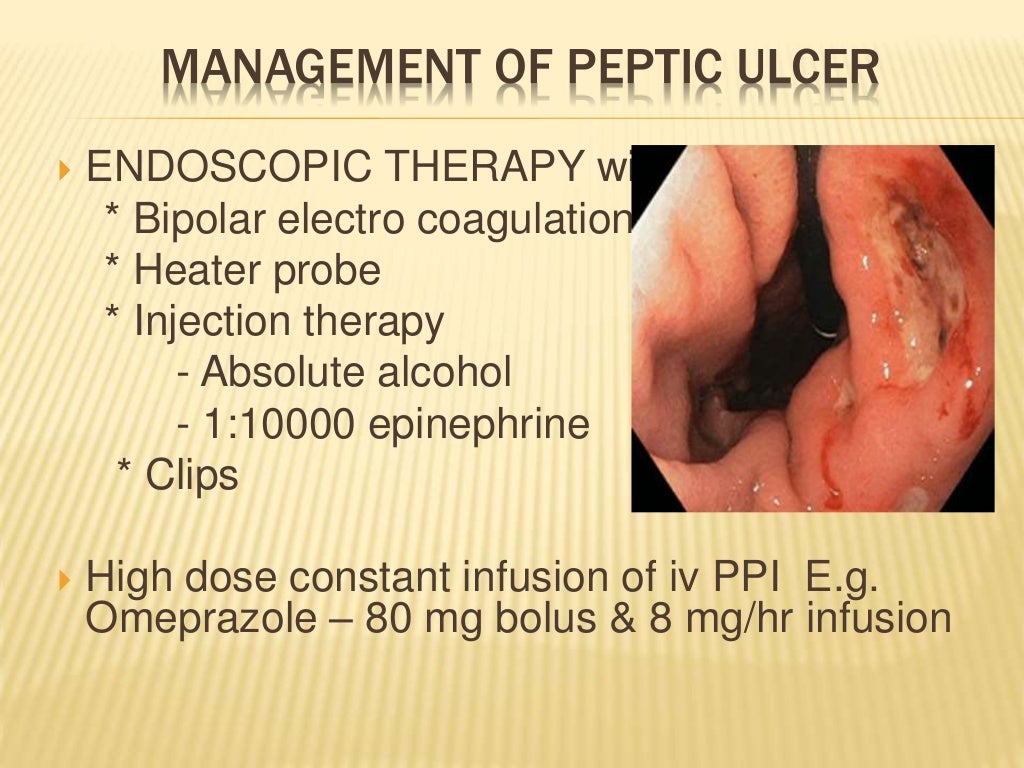 Peptic ulcer & upper gi bleeding