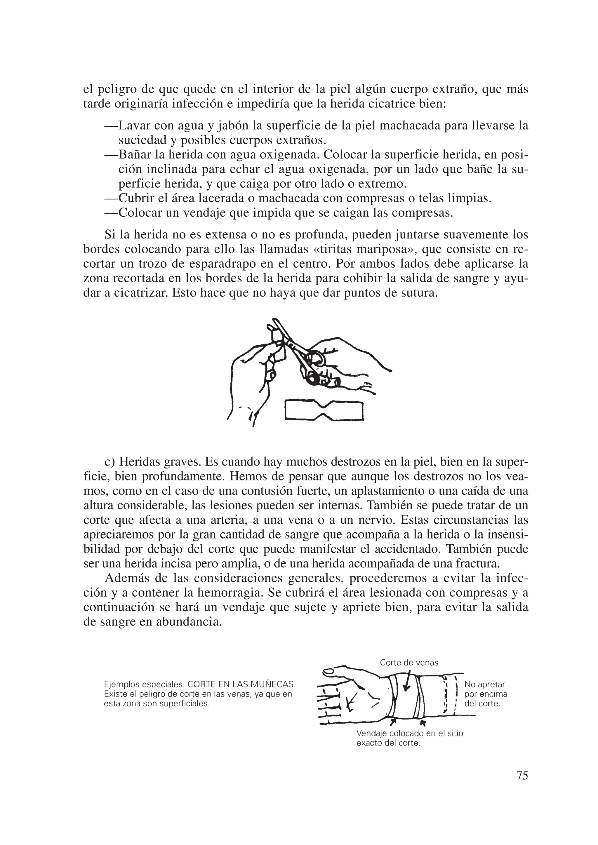 el peligro de que quede en el interior de la piel algún cuerpo extraño, que más
tarde originaría infección e impediría que la herida cicatrice bien:
   —Lavar con agua y jabón la superficie de la piel machacada para llevarse la
    suciedad y posibles cuerpos extraños.
   —Bañar la herida con agua oxigenada. Colocar la superficie herida, en posi-
    ción inclinada para echar el agua oxigenada, por un lado que bañe la su-
    perficie herida, y que caiga por otro lado o extremo.
   —Cubrir el área lacerada o machacada con compresas o telas limpias.
   —Colocar un vendaje que impida que se caigan las compresas.
    Si la herida no es extensa o no es profunda, pueden juntarse suavemente los
bordes colocando para ello las llamadas «tiritas mariposa», que consiste en re-
cortar un trozo de esparadrapo en el centro. Por ambos lados debe aplicarse la
zona recortada en los bordes de la herida para cohibir la salida de sangre y ayu-
dar a cicatrizar. Esto hace que no haya que dar puntos de sutura.




     c) Heridas graves. Es cuando hay muchos destrozos en la piel, bien en la super-
ficie, bien profundamente. Hemos de pensar que aunque los destrozos no los vea-
mos, como en el caso de una contusión fuerte, un aplastamiento o una caída de una
altura considerable, las lesiones pueden ser internas. También se puede tratar de un
corte que afecta a una arteria, a una vena o a un nervio. Estas circunstancias las
apreciaremos por la gran cantidad de sangre que acompaña a la herida o la insensi-
bilidad por debajo del corte que puede manifestar el accidentado. También puede
ser una herida incisa pero amplia, o de una herida acompañada de una fractura.
     Además de las consideraciones generales, procederemos a evitar la infec-
ción y a contener la hemorragia. Se cubrirá el área lesionada con compresas y a
continuación se hará un vendaje que sujete y apriete bien, para evitar la salida
de sangre en abundancia.




                                                                                 75
 