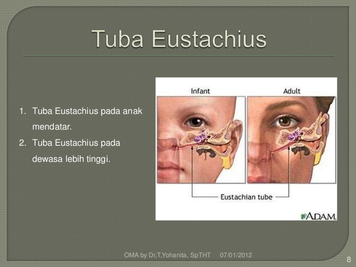 Peradangan telinga tengah