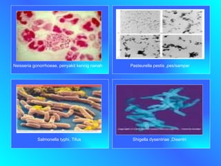Neisseria gonorrhoeae, penyakit kencig nanah Pasteurella pestis ,pes/sampar Salmonella typhi, Tifus Shigella dysentriae ,Disentri 