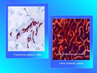 Treponema palidum ,sifilis Vibrio cholerae ,kolera 