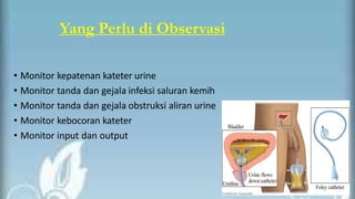 Yang Perlu di Observasi
• Monitor kepatenan kateter urine
• Monitor tanda dan gejala infeksi saluran kemih
• Monitor tanda dan gejala obstruksi aliran urine
• Monitor kebocoran kateter
• Monitor input dan output
 