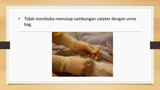 • Tidak membuka menutup sambungan cateter dengan urine
bag
 