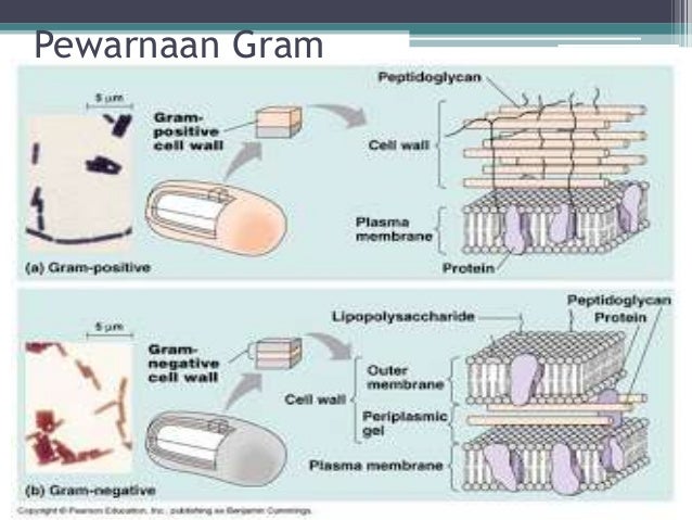 Perbedaan sel prokariotik & prokariotik