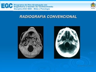 DISCIPLINA EGC 8008 – Midia e Psicologia RADIOGRAFIA CONVENCIONAL Edemir Costa Disciplina EGC 8008 – Mídia e Psicologia 