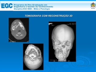 DISCIPLINA EGC 8008 – Midia e Psicologia TOMOGRAFIA COM RECONSTRUÇÃO 3D  Edemir Costa Disciplina EGC 8008 – Mídia e Psicologia 