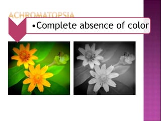 •Complete absence of color
 