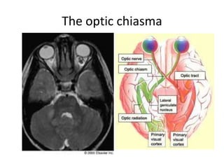 The optic chiasma
 