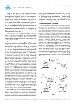 Percutaneous tracheostomy-advantages-and-complications-nhc-16-103 | PDF