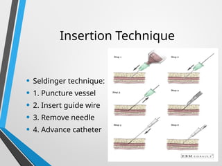Insertion Technique
• Seldinger technique:
• 1. Puncture vessel
• 2. Insert guide wire
• 3. Remove needle
• 4. Advance catheter
 
