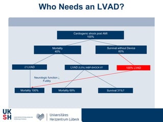 Who Needs an LVAD?
Mortality
40%
Cardiogenic shock post AMI
100%
Survival without Device
60%
 LVAD
Mortality 100%
Neurologic function ↓
Futility
LVAD (5,5%) IABP-SHOCK II?
Survival 31%?Mortality 69%
100% LVAD
 