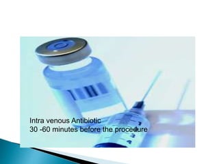 Percutaneous coblation disc nucleoplasty | PPTX