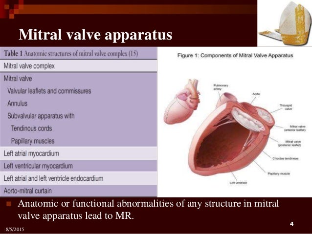 percutaneous treatment strategies of valvular heart disease 4 638