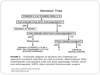 LAA OCCLUSION FOR STROKE
PREVENTION IN AF
 