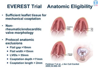 EVEREST Trial Anatomic Eligibility
• Sufficient leaflet tissue for
mechanical coaptation
• Non-
rheumatic/endocarditic
valve morphology
• Protocol anatomic
exclusions
 Flail gap >10mm
 Flail width >15mm
 LVIDs > 55mm
 Coaptation depth >11mm
 Coaptation length < 2mm Feldman T et al., J Am Coll Cardiol
2009;54:686–94
 