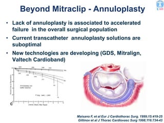Beyond Mitraclip - Annuloplasty
• Lack of annuloplasty is associated to accelerated
failure in the overall surgical population
• Current transcatheter annuloplasty solutions are
suboptimal
• New technologies are developing (GDS, Mitralign,
Valtech Cardioband)
Maisano F, et al Eur J Cardiothorac Surg. 1999;15:419-25
Gillinov et al J Thorac Cardiovasc Surg 1998;116:734-43
 