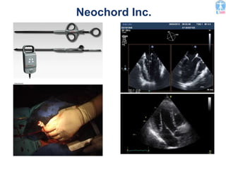 Neochord Inc.
 