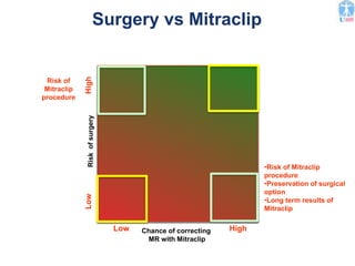 Surgery vs Mitraclip
Chance of correcting
MR with Mitraclip
RiskofsurgeryLowHigh
Low High
Risk of
Mitraclip
procedure
•Risk of Mitraclip
procedure
•Preservation of surgical
option
•Long term results of
Mitraclip
 