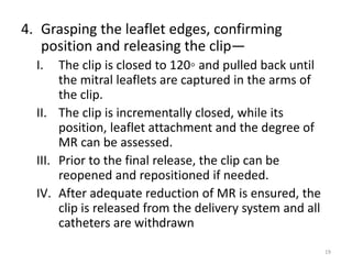 4. Grasping the leaflet edges, confirming
position and releasing the clip—
I. The clip is closed to 120◦ and pulled back until
the mitral leaflets are captured in the arms of
the clip.
II. The clip is incrementally closed, while its
position, leaflet attachment and the degree of
MR can be assessed.
III. Prior to the final release, the clip can be
reopened and repositioned if needed.
IV. After adequate reduction of MR is ensured, the
clip is released from the delivery system and all
catheters are withdrawn
19
 