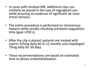 • In cases with residual MR, additional clips can
similarly be placed in the way of regurgitant jets
while ensuring no evidence of significant de novo
mitral stenosis.
• The entire procedure is performed on intravenous
heparin while serially checking activated coagulation
time (goal >250 s).
• After the clip is placed, patients are treated with
aspirin 325mg daily for 6–12 months and clopidogrel
75mg daily for 30 days.
• These recommendations are based on estimated
time to device endothelialization.
20
 