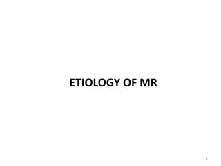 ETIOLOGY OF MR
3
 