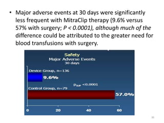 • Major adverse events at 30 days were significantly
less frequent with MitraClip therapy (9.6% versus
57% with surgery; P < 0.0001), although much of the
difference could be attributed to the greater need for
blood transfusions with surgery.
30
 