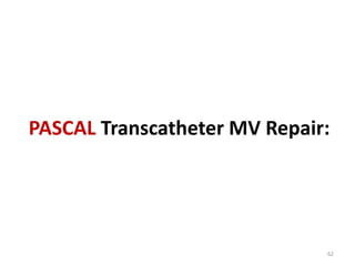 PASCAL Transcatheter MV Repair:
62
 