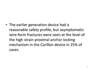 • The earlier generation device had a
reasonable safety profile, but asymptomatic
wire-form fractures were seen at the level of
the high strain proximal anchor locking
mechanism in the Carillon device in 25% of
cases.
72
 