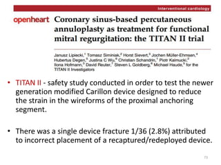 • TITAN II - safety study conducted in order to test the newer
generation modified Carillon device designed to reduce
the strain in the wireforms of the proximal anchoring
segment.
• There was a single device fracture 1/36 (2.8%) attributed
to incorrect placement of a recaptured/redeployed device.
73
 