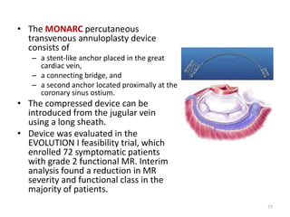 • The MONARC percutaneous
transvenous annuloplasty device
consists of
– a stent-like anchor placed in the great
cardiac vein,
– a connecting bridge, and
– a second anchor located proximally at the
coronary sinus ostium.
• The compressed device can be
introduced from the jugular vein
using a long sheath.
• Device was evaluated in the
EVOLUTION I feasibility trial, which
enrolled 72 symptomatic patients
with grade 2 functional MR. Interim
analysis found a reduction in MR
severity and functional class in the
majority of patients.
77
 