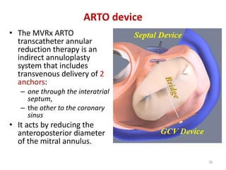 ARTO device
• The MVRx ARTO
transcatheter annular
reduction therapy is an
indirect annuloplasty
system that includes
transvenous delivery of 2
anchors:
– one through the interatrial
septum,
– the other to the coronary
sinus
• It acts by reducing the
anteroposterior diameter
of the mitral annulus.
78
 