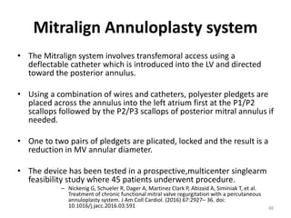 Mitralign Annuloplasty system
• The Mitralign system involves transfemoral access using a
deflectable catheter which is introduced into the LV and directed
toward the posterior annulus.
• Using a combination of wires and catheters, polyester pledgets are
placed across the annulus into the left atrium first at the P1/P2
scallops followed by the P2/P3 scallops of posterior mitral annulus if
needed.
• One to two pairs of pledgets are plicated, locked and the result is a
reduction in MV annular diameter.
• The device has been tested in a prospective,multicenter singlearm
feasibility study where 45 patients underwent procedure.
– Nickenig G, Schueler R, Dager A, Martinez Clark P, Abizaid A, Siminiak T, et al.
Treatment of chronic functional mitral valve regurgitation with a percutaneous
annuloplasty system. J Am Coll Cardiol. (2016) 67:2927– 36. doi:
10.1016/j.jacc.2016.03.591 88
 