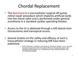 Chordal Replacement
• The Neochord is a transcatheter surgical off-pump
mitral repair procedure which implants artificial cords
into the mitral valve and is performed under general
anesthesia in a standard cardiac operating theater.
• Access to the LV is obtained through a left lateral mini-
thoracotomy and transapical access.
• Several studies on the safety and efficacy of such a
transcatheter strategy in reducing MR have been
published.
» Colli A, Manzan E, Aidietis A, Rucinskas K, Bizzotto E, Besola L, et al. An early
European experience with transapical off-pump mitral valve repair with
NeoChord implantation. Eur J Cardiothorac Surg. (2018) 54:460–6. doi:
10.1093/ejcts/ezy064
92
 