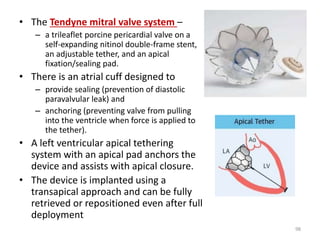 • The Tendyne mitral valve system –
– a trileaflet porcine pericardial valve on a
self-expanding nitinol double-frame stent,
an adjustable tether, and an apical
fixation/sealing pad.
• There is an atrial cuff designed to
– provide sealing (prevention of diastolic
paravalvular leak) and
– anchoring (preventing valve from pulling
into the ventricle when force is applied to
the tether).
• A left ventricular apical tethering
system with an apical pad anchors the
device and assists with apical closure.
• The device is implanted using a
transapical approach and can be fully
retrieved or repositioned even after full
deployment
98
 