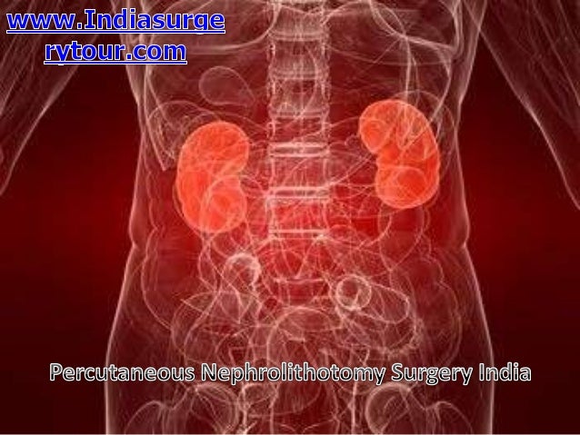 Percutaneous Nephrolithotomy Surgery India