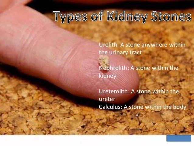 Percutaneous Nephrolithotomy Surgery India