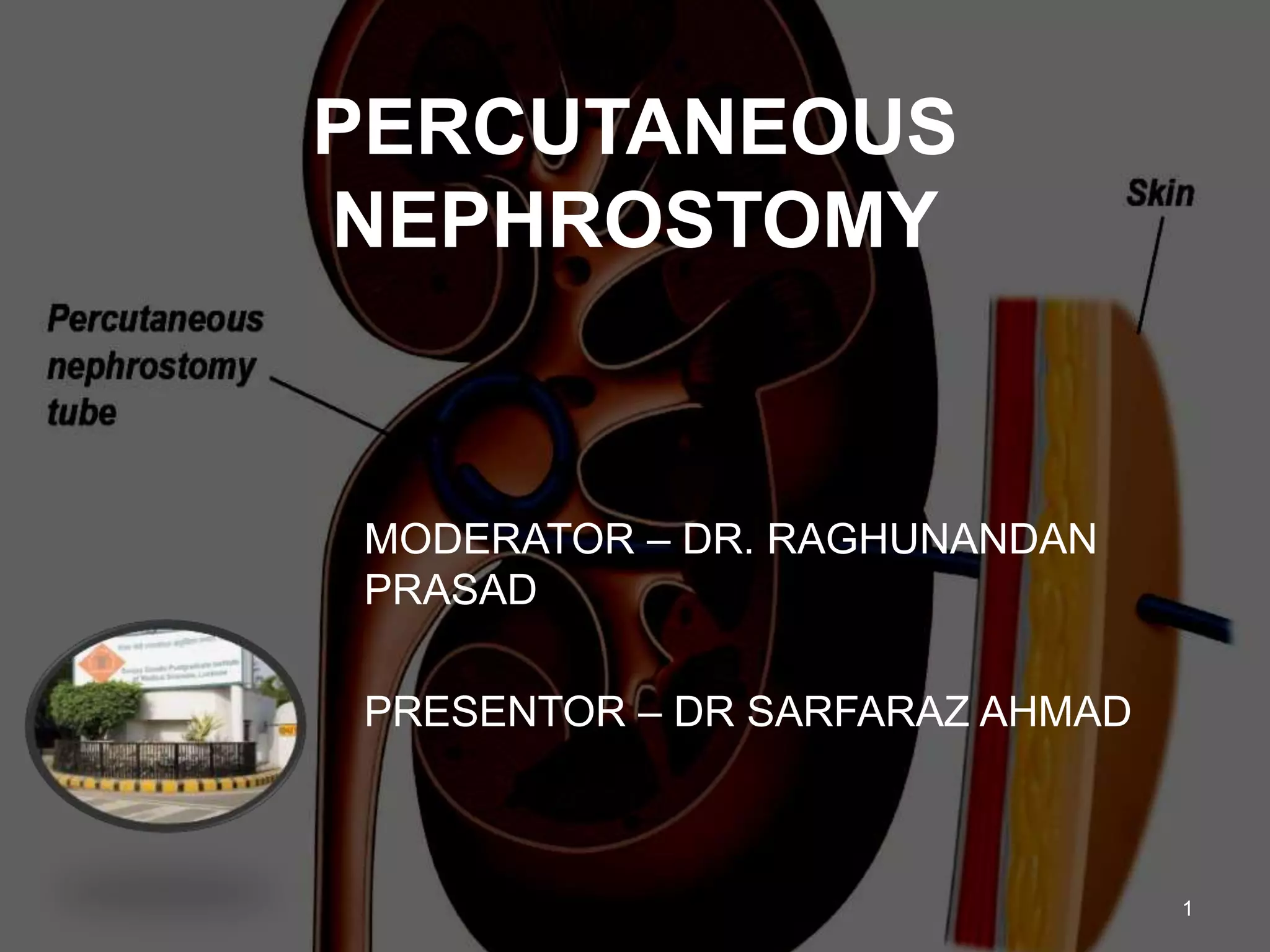 Percutaneous nephrostomy | PPTX