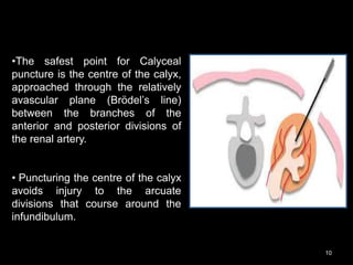 10
•The safest point for Calyceal
puncture is the centre of the calyx,
approached through the relatively
avascular plane (Brödel’s line)
between the branches of the
anterior and posterior divisions of
the renal artery.
• Puncturing the centre of the calyx
avoids injury to the arcuate
divisions that course around the
infundibulum.
 
