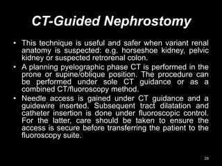 CT-Guided Nephrostomy
• This technique is useful and safer when variant renal
anatomy is suspected: e.g. horseshoe kidney, pelvic
kidney or suspected retrorenal colon.
• A planning pyelographic phase CT is performed in the
prone or supine/oblique position. The procedure can
be performed under sole CT guidance or as a
combined CT/fluoroscopy method.
• Needle access is gained under CT guidance and a
guidewire inserted. Subsequent tract dilatation and
catheter insertion is done under fluoroscopic control.
For the latter, care should be taken to ensure the
access is secure before transferring the patient to the
fluoroscopy suite.
29
 