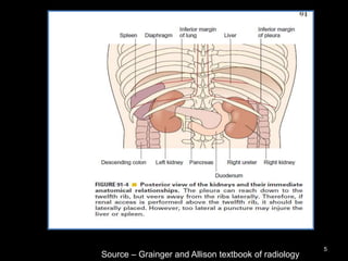 5
Source – Grainger and Allison textbook of radiology
 