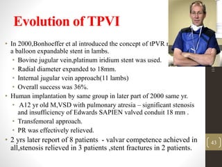 Evolution of TPVI
• In 2000,Bonhoeffer et al introduced the concept of tPVR mounted on
a balloon expandable stent in lambs.
• Bovine jugular vein,platinum iridium stent was used.
• Radial diameter expanded to 18mm.
• Internal jugular vein approach(11 lambs)
• Overall success was 36%.
• Human implantation by same group in later part of 2000 same yr.
• A12 yr old M,VSD with pulmonary atresia – significant stenosis
and insufficiency of Edwards SAPIEN valved conduit 18 mm .
• Transfemoral approach.
• PR was effectively relieved.
• 2 yrs later report of 8 patients - valvar competence achieved in
all,stenosis relieved in 3 patients ,stent fractures in 2 patients.
11/4/2015
43
 