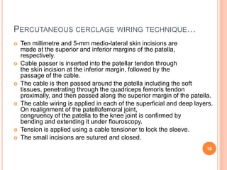Percutaneous treatment of communited patellar fracture.pptx