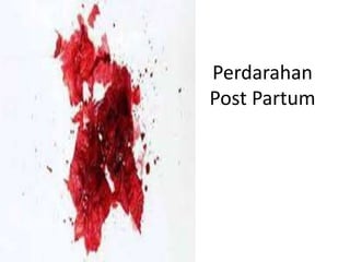 Perdarahan
Post Partum
 