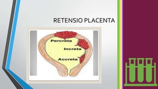RETENSIO PLACENTA
 
