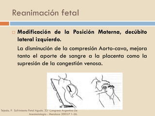 Reanimación fetal
Tejeda. P. Sufrimiento Fetal Agudo. 32º Congreso Argentino De
Anestesiología - Mendoza 2003.P 1-26.
 Modificación de la Posición Materna, decúbito
lateral izquierdo.
La disminución de la compresión Aorto-cava, mejora
tanto el aporte de sangre a la placenta como la
supresión de la congestión venosa.
 